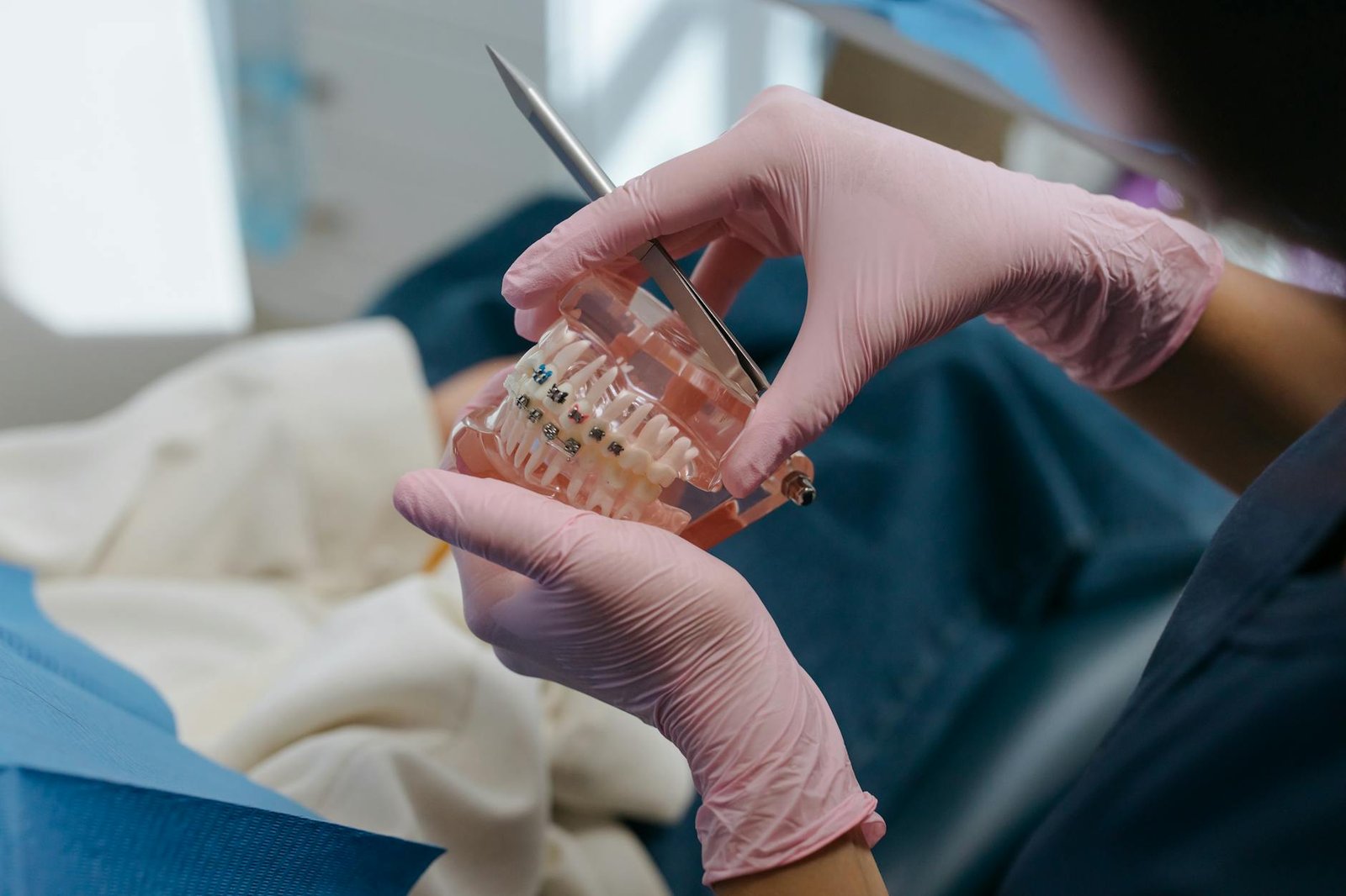 Illustration of Braces Duration Nagpur: Stunning Results at Affordable Sandhya Dental