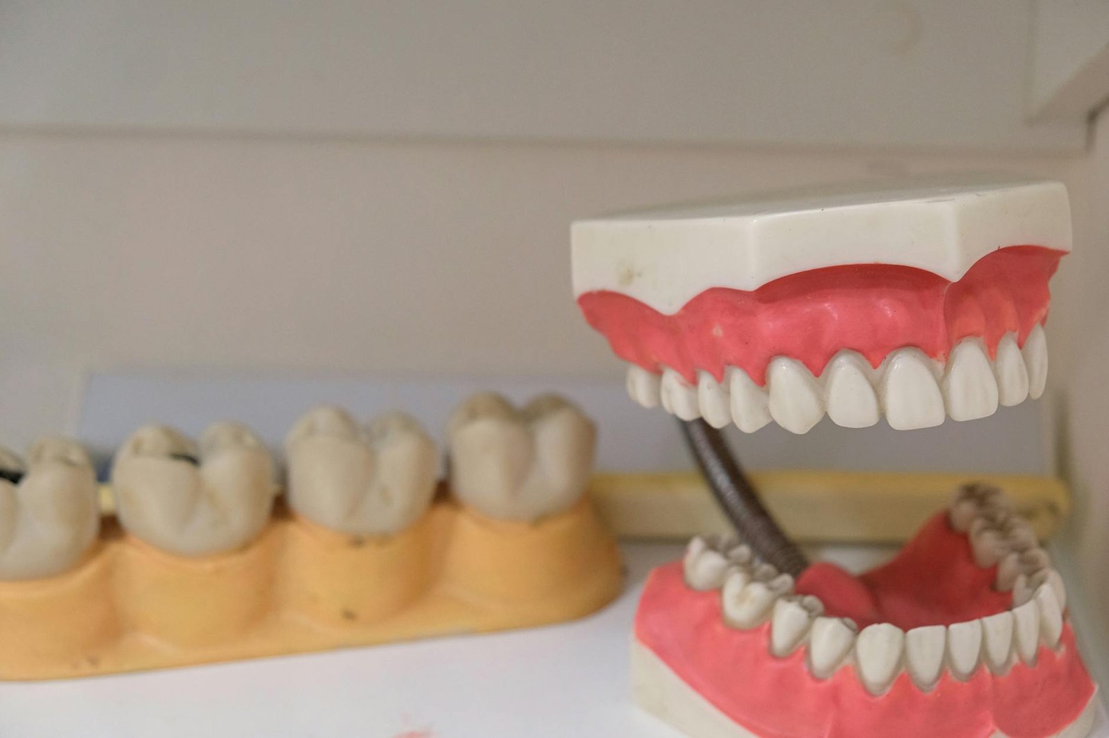 Illustration of Partial Dentures Nagpur: Must-Have Tooth Replacement at Sandhya Dental