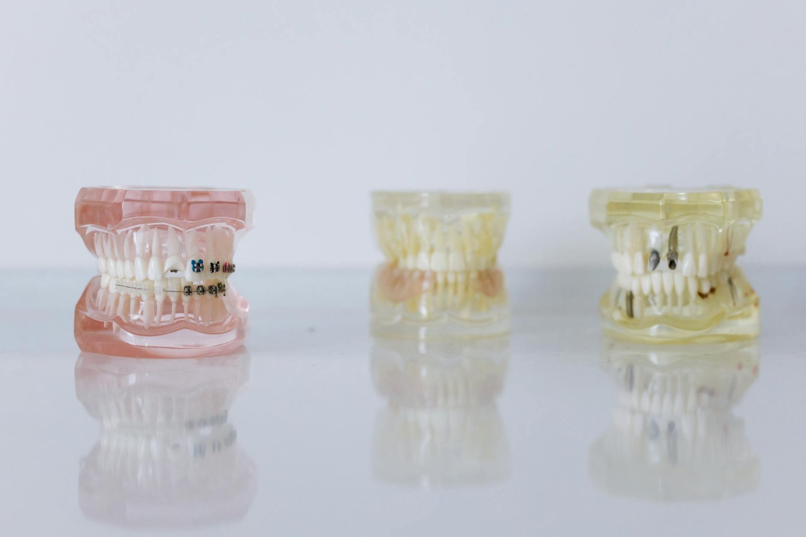Illustration of Sandhya Dental for Dental Implants in Nagpur – Exclusive Best Care