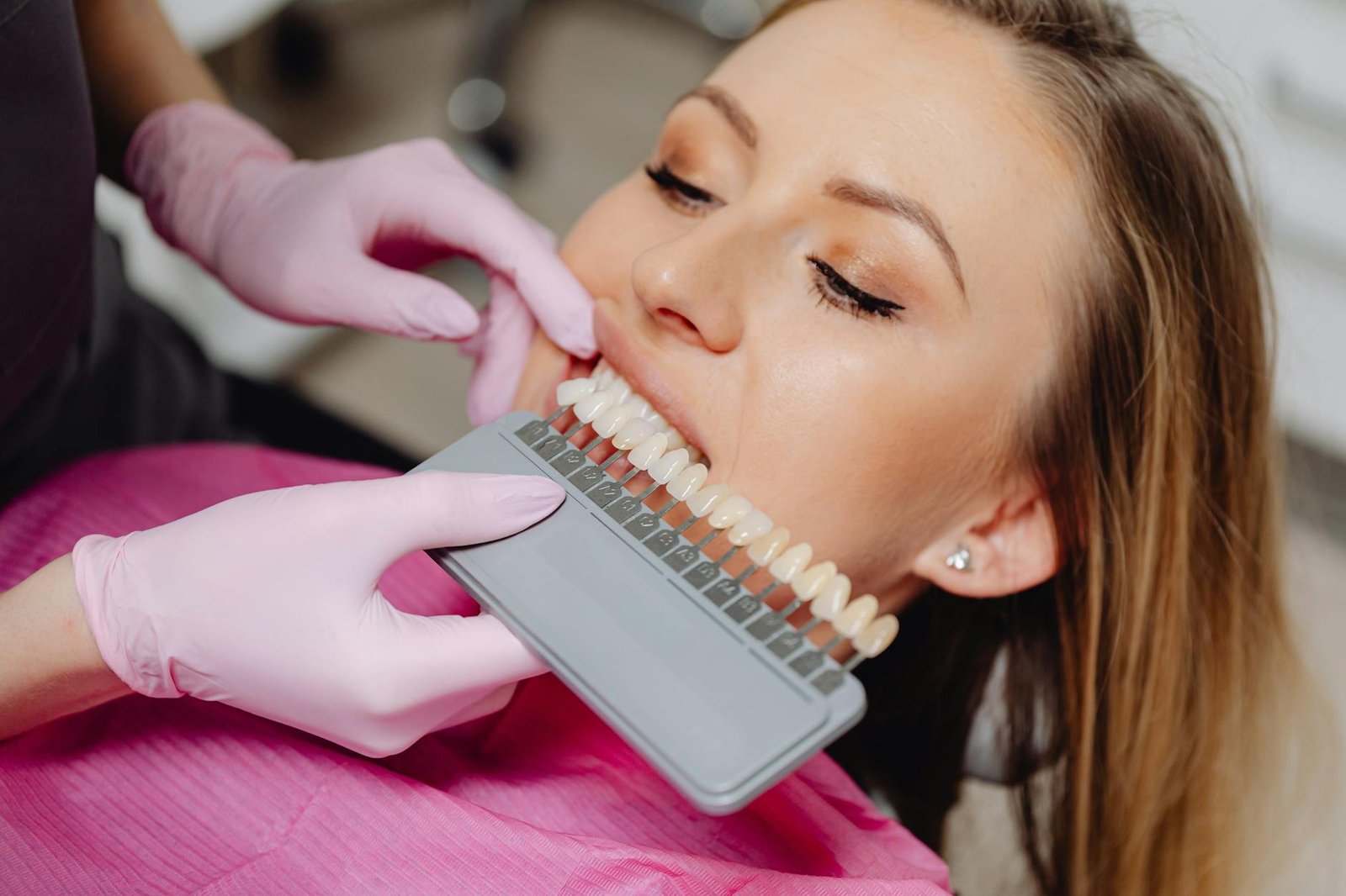 Illustration of Teeth Whitening Nagpur: Best Stunning Options at Sandhya Dental